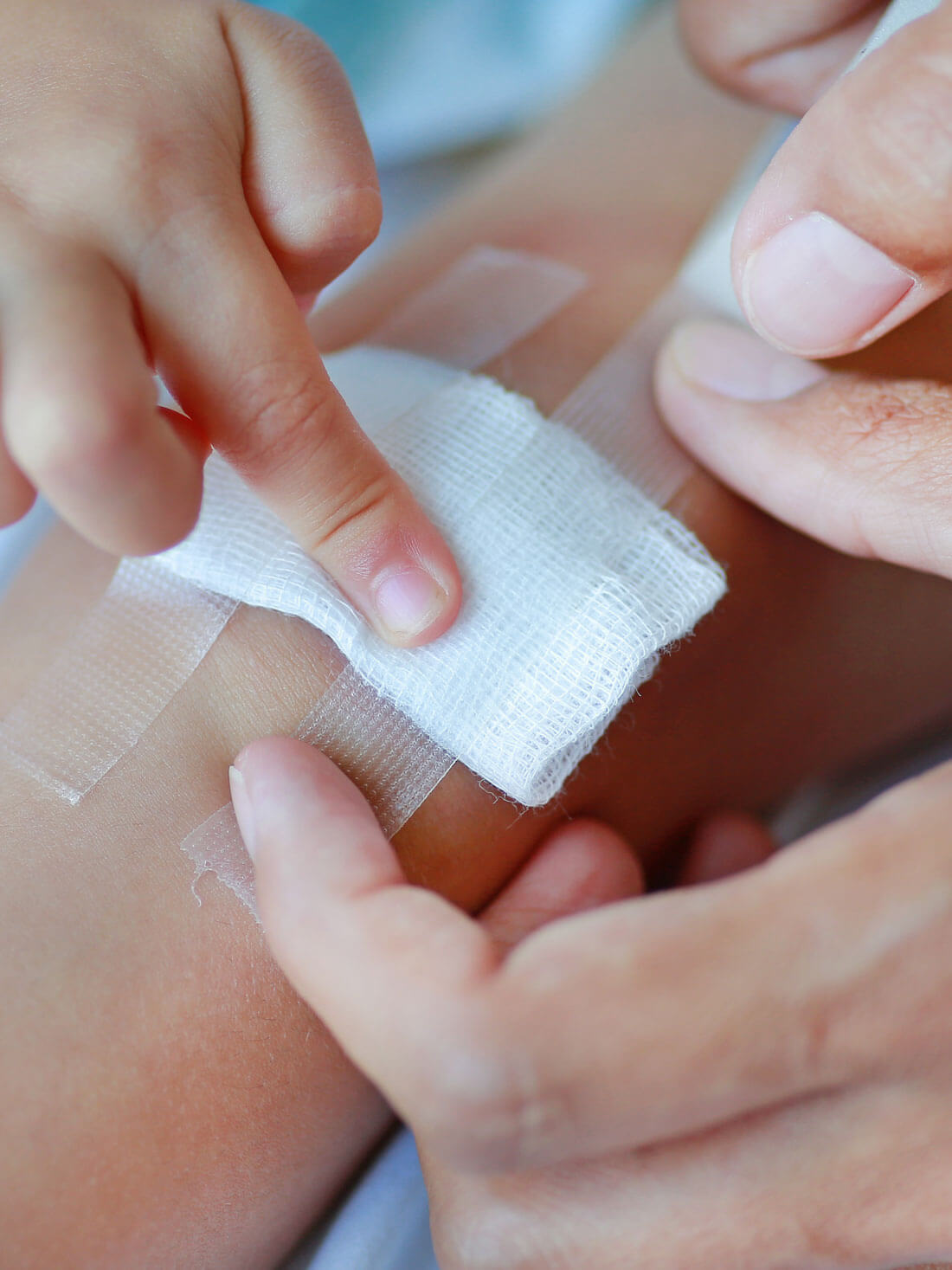 Close Up Wound On Child Knee. Mother Dressing Child's Knee.